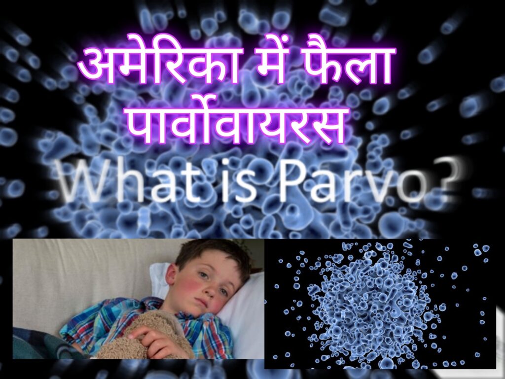 Cdc Parvovirus B19 Hindi पार्वोवायरस बी19 खतरनाक वायरस अमेरिका