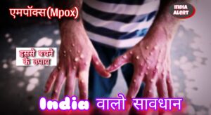 Mpox Kya Kar Sakta Hain In Hindi 