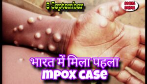  India Mpox Cases News 2024